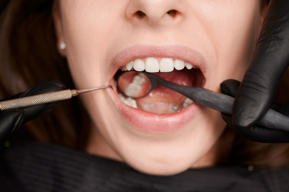 Why You Keep Getting Cavities (Even With Good Habits)